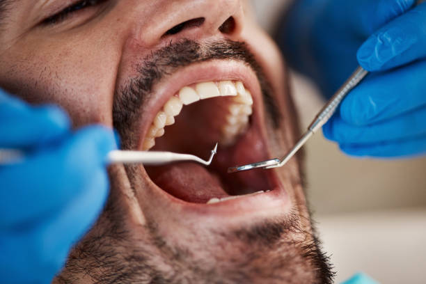 Best Emergency Dental Extractions in Danville, KY