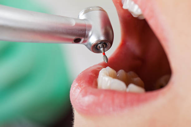 Best Emergency Dentist for Special Needs Patients in Danville, KY